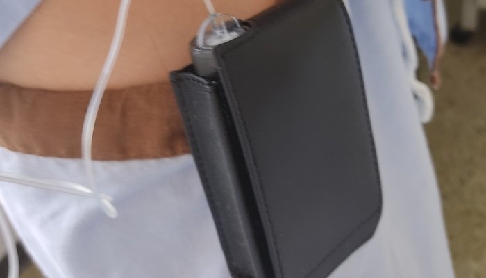Máquina subcutánea de administración de medicamento para el tratamiento de la hipertensión pulmonar. Elaboración propia.