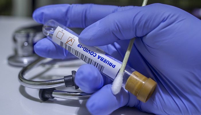 Prueba PCR de Covid 19